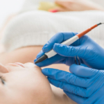 Electrolysis Permanent Hair Removal Service BodyFocus Spa