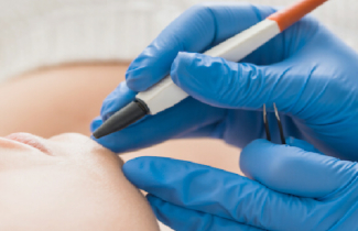 Electrolysis – Permanent Hair Removal Body Focus Spa Harare
