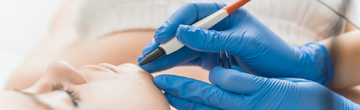 Electrolysis – Permanent Hair Removal Body Focus Spa Harare